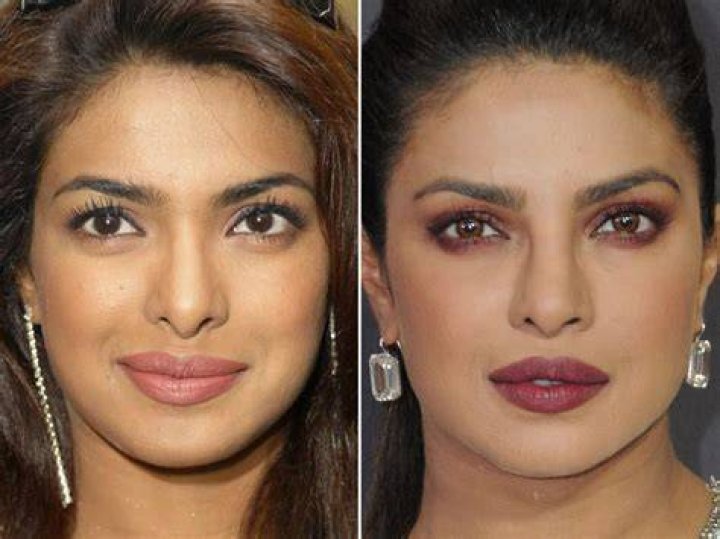 Priyanka Chopra.. Before and after plastic surgery!😳 Celebrity